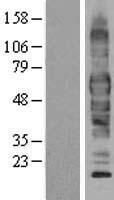EAAT3 (SLC1A1) Human Over-expression Lysate