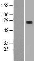 SDHA Human Over-expression Lysate