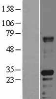 HABP2 Human Over-expression Lysate