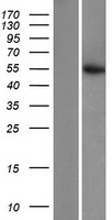 Citrate synthetase (CS) Human Over-expression Lysate