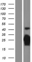 p27 KIP 1 (CDKN1B) Human Over-expression Lysate