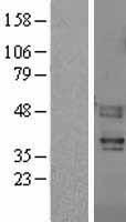 Proteinase Activated Receptor 4 (F2RL3) Human Over-expression Lysate
