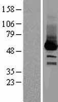 Selenium Binding Protein 1 (SELENBP1) Human Over-expression Lysate