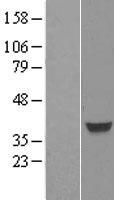FOXH1 Human Over-expression Lysate