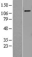 PRPF4B Human Over-expression Lysate