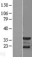 p35 (CDK5R1) Human Over-expression Lysate