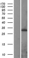 PEX11A Human Over-expression Lysate