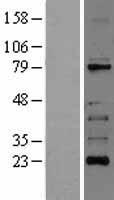 RIP (RIPK1) Human Over-expression Lysate