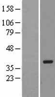 PRKRA Human Over-expression Lysate