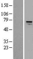 Alkyl DHAP synthase (AGPS) Human Over-expression Lysate