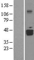 D aspartate oxidase (DDO) Human Over-expression Lysate
