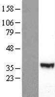 PI 3 Kinase p55 gamma (PIK3R3) Human Over-expression Lysate