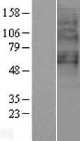 GPR65 Human Over-expression Lysate