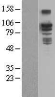 BCAR3 Human Over-expression Lysate