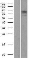 MAD1 (MAD1L1) Human Over-expression Lysate
