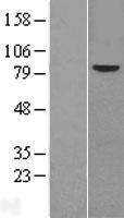 Frizzled 6 (FZD6) Human Over-expression Lysate
