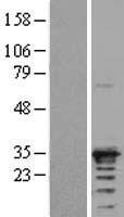 ARD1A (NAA10) Human Over-expression Lysate
