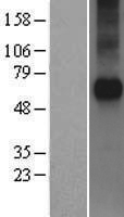 Frizzled 5 (FZD5) Human Over-expression Lysate