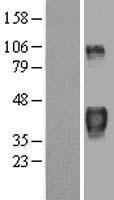Tristetraprolin (ZFP36) Human Over-expression Lysate