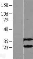 UBE2H Human Over-expression Lysate