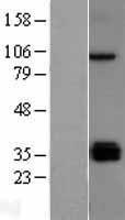 TLR5 Human Over-expression Lysate