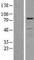 TIAL1 Human Over-expression Lysate