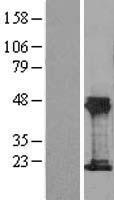 THRSP Human Over-expression Lysate