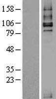 TGF beta Receptor III (TGFBR3) Human Over-expression Lysate