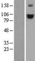 Transferrin Receptor 2 (TFR2) Human Over-expression Lysate