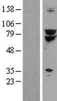 TCF3 / E2A (TCF3) Human Over-expression Lysate