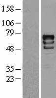 S6K1 (RPS6KB1) Human Over-expression Lysate