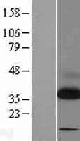 TRAP alpha (SSR1) Human Over-expression Lysate