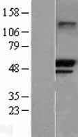 TRIM21 Human Over-expression Lysate