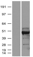 SNF5 (SMARCB1) Human Over-expression Lysate