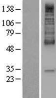 Monocarboxylic acid transporter 1 (SLC16A1) Human Over-expression Lysate
