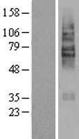 Solute carrier family 22 member 5 (SLC22A5) Human Over-expression Lysate