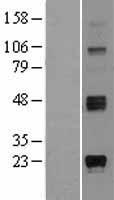 ST8SIA1 Human Over-expression Lysate