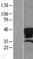 Surfactant protein D (SFTPD) Human Over-expression Lysate