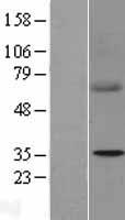 SDHB Human Over-expression Lysate