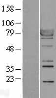 RSK1 p90 (RPS6KA1) Human Over-expression Lysate