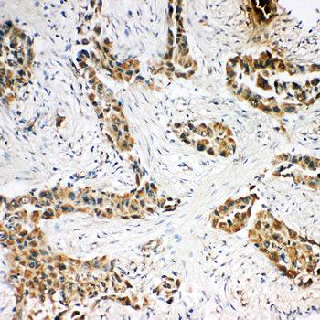 Anti-Caspase-3 (P10)/CASP3 Antibody