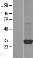 RIT2 Human Over-expression Lysate