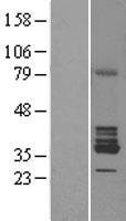 RDH5 Human Over-expression Lysate