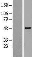 hHR23b (RAD23B) Human Over-expression Lysate