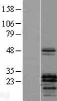 Parathyroid hormone related protein (PTHLH) Human Over-expression Lysate