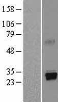 Trypsin (PRSS1) Human Over-expression Lysate