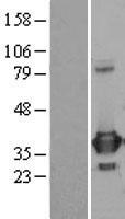 PRPS1 Human Over-expression Lysate