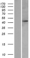 Protein Kinase A regulatory subunit I alpha (PRKAR1A) Human Over-expression Lysate
