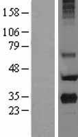 Major Basic Protein (PRG2) Human Over-expression Lysate