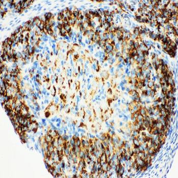 Anti-HSD17B1 Antibody